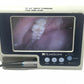 VERATHON Glidescope Portable GVL Video Laryngoscope Monitor