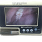 VERATHON Glidescope Portable GVL Video Laryngoscope Monitor