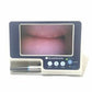 VERATHON Glidescope Portable GVL Video Laryngoscope Monitor 0231-0003