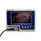 VERATHON Glidescope Portable GVL Video Laryngoscope Monitor W 1/2 & 4/4 Camera button