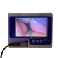 VERATHON Glidescope Portable GVL Video Laryngoscope Monitor W 1/2 & 4/4 Camera button