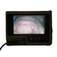 VERATHON Glidescope Portable GVL Video Laryngoscope Monitor W 1/2 & 4/4 Camera button