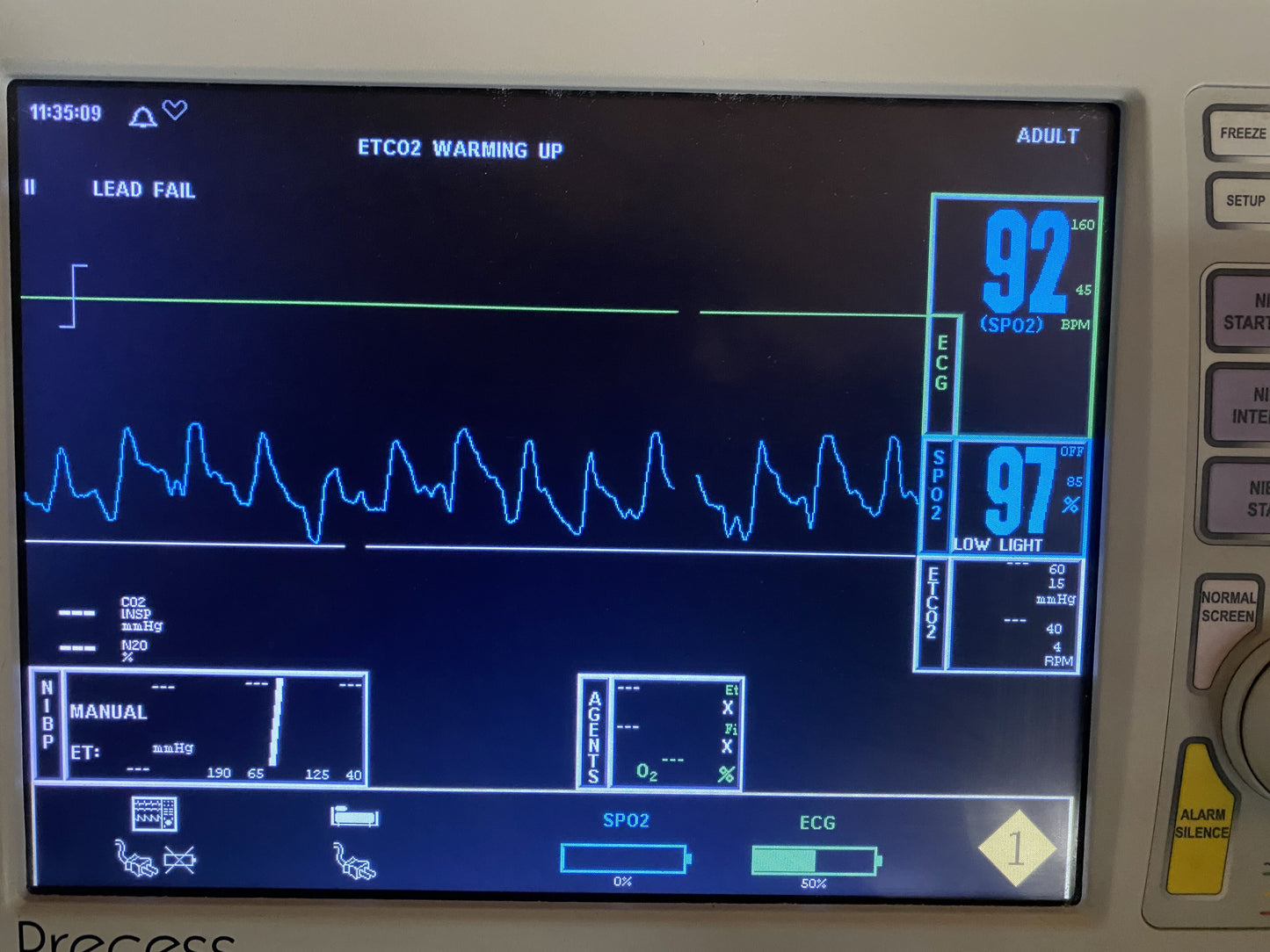 Invivo 9311 Channel 1 Wireless SpO2 Module With 9399C Spo2 Clip Sensor