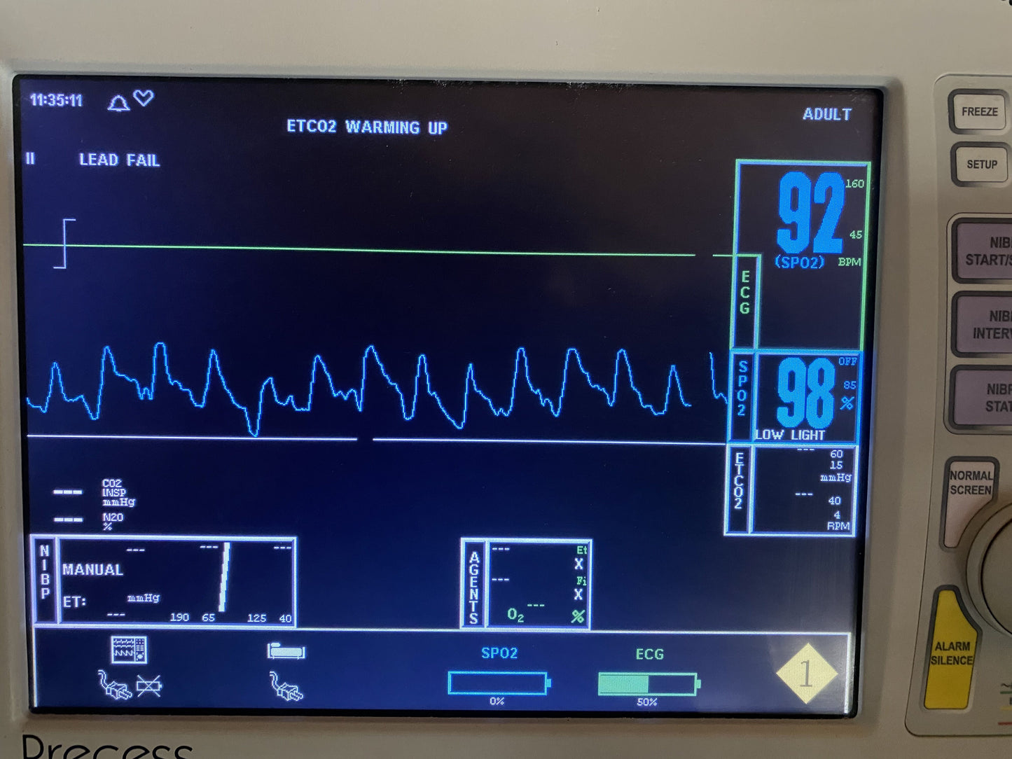 Invivo 9311 Channel 1 Wireless SpO2 Module With 9399C Spo2 Clip Sensor
