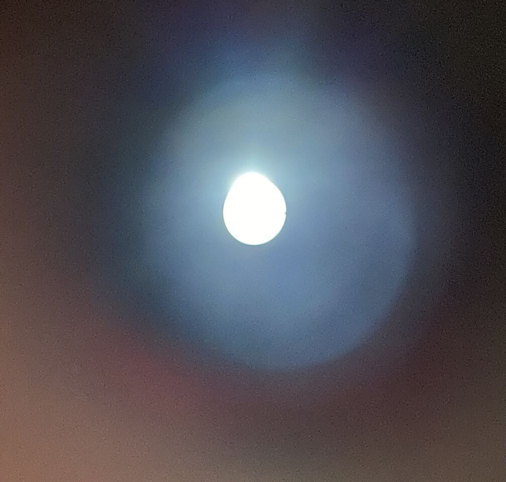 KARL STORZ 11263BBU 1 FLEXIBLE HYSTEROSCOPE Hysteroscope