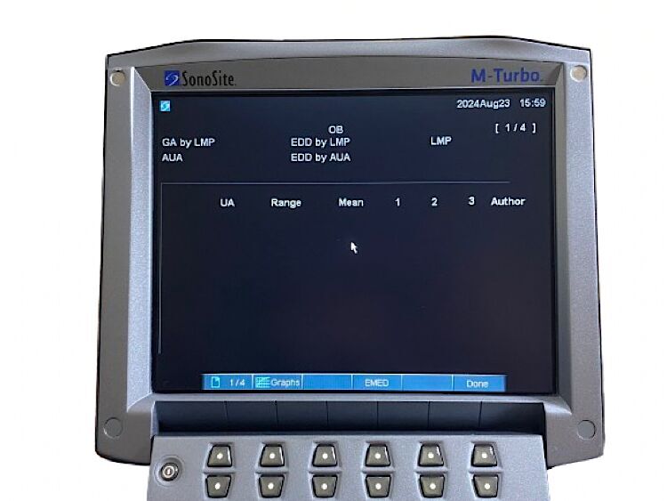 SONOSITE M-Turbo SONOSITE M-Turbo Portable Ultrasound SYSTEM