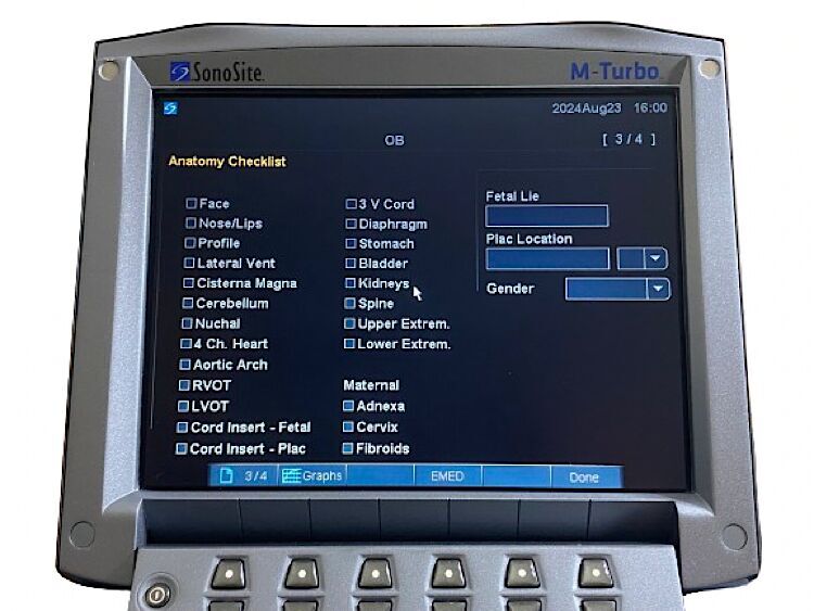 SONOSITE M-Turbo SONOSITE M-Turbo Portable Ultrasound SYSTEM