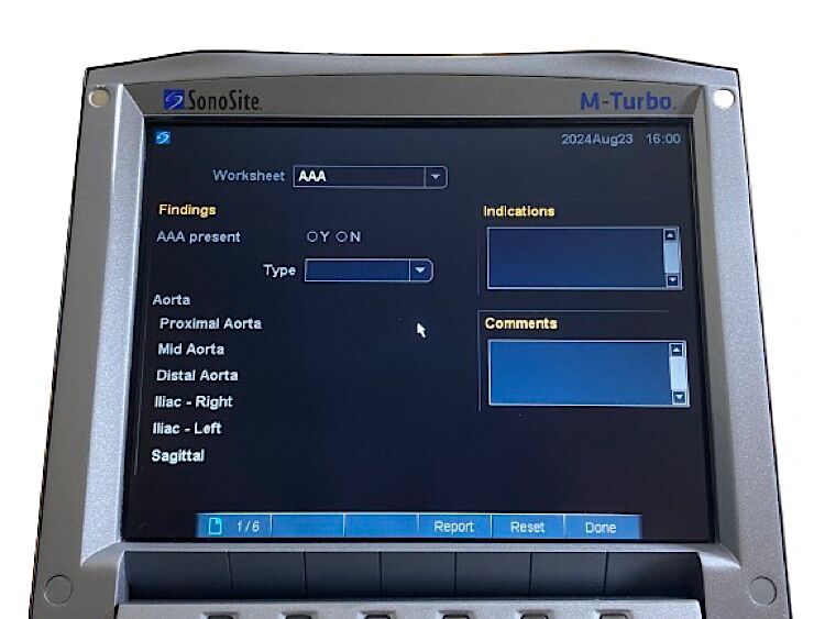 SONOSITE M-Turbo SONOSITE M-Turbo Portable Ultrasound SYSTEM