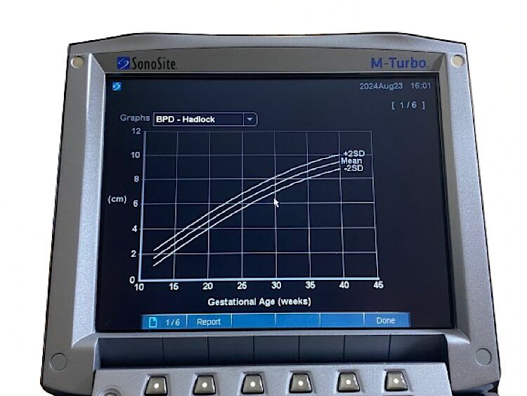 SONOSITE M-Turbo SONOSITE M-Turbo Portable Ultrasound SYSTEM
