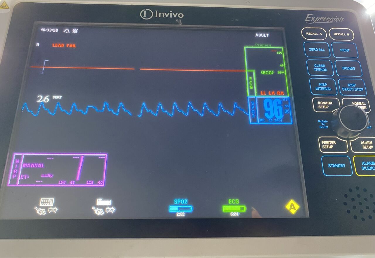 INVIVO MRI REF-453564189331 SPO2 SENSOR CABLE SPO2 Probe