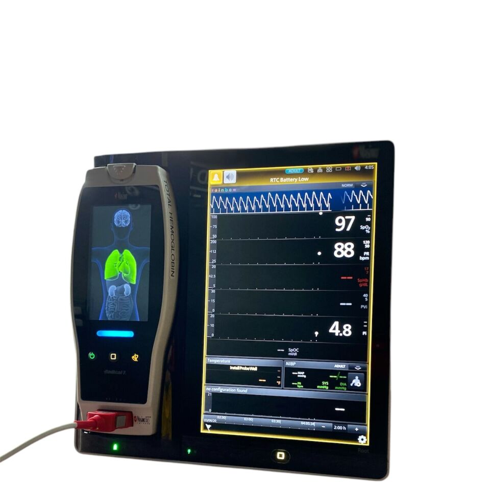 MASIMO Root Multiparameter SpHb,SpCo,Pvi,SpO2 With Radical-7 Touch Screen Monitor Monitor