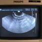 ATL Philips Transvaginal Endovaginal Ultrasound Probe