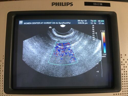 ATL Philips Transvaginal Endovaginal Ultrasound Probe