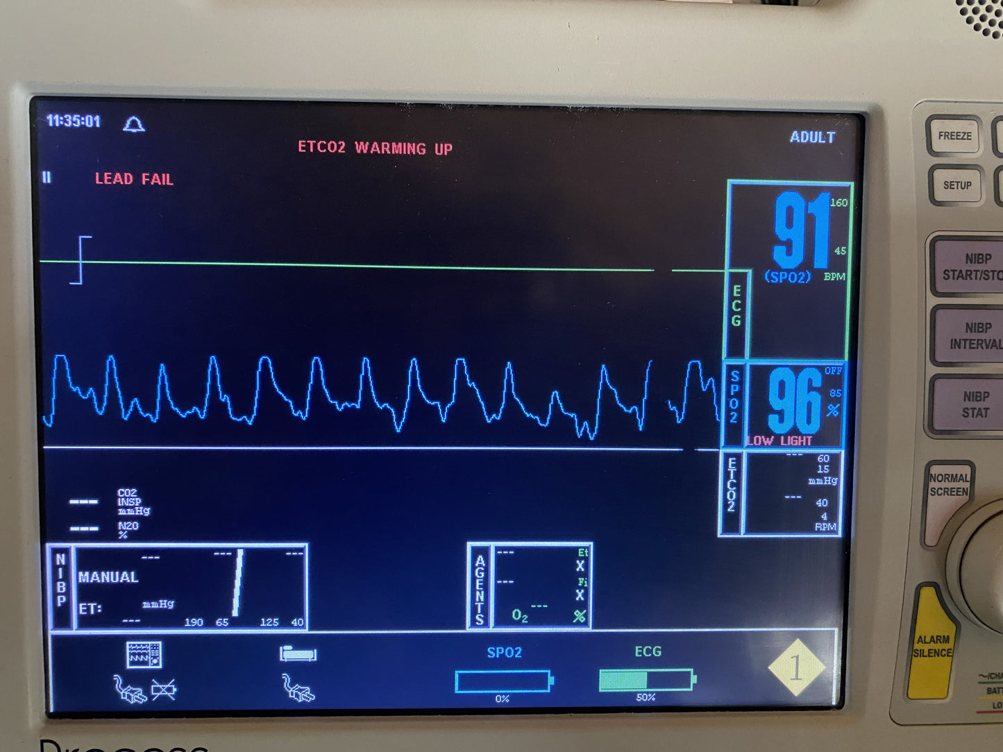 Invivo  MRI OXICLIP REF-9399C SPO2 FINGER SENSOR